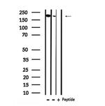 Phospho-BRCA1 (Ser1497) Antibody in Western Blot (WB)