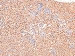 Phospho-BCLAF1 (Ser531) Antibody in Immunohistochemistry (Paraffin) (IHC (P))