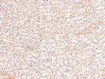 Phospho-BCLAF1 (Ser531) Antibody in Immunohistochemistry (Paraffin) (IHC (P))