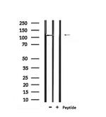 Phospho-BCLAF1 (Ser531) Antibody in Western Blot (WB)