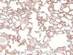 Phospho-delta Catenin (Tyr257) Antibody in Immunohistochemistry (Paraffin) (IHC (P))