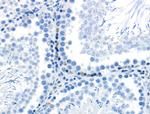 Phospho-Cyclin B1 (Ser128) Antibody in Immunohistochemistry (Paraffin) (IHC (P))