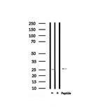 Phospho-RGS19 (Ser151) Antibody in Western Blot (WB)