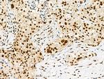 Phospho-LIMK1 (Ser310) Antibody in Immunohistochemistry (Paraffin) (IHC (P))