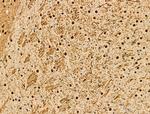 Phospho-LIMK1 (Ser310) Antibody in Immunohistochemistry (Paraffin) (IHC (P))