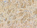 Phospho-LIMK1 (Ser310) Antibody in Immunohistochemistry (Paraffin) (IHC (P))