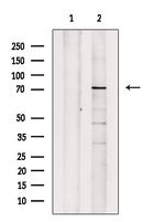 Phospho-LIMK1 (Ser310) Antibody in Western Blot (WB)