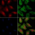 Phospho-MBP (Thr232) Antibody in Immunocytochemistry (ICC/IF)