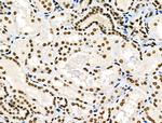 Phospho-MUC1 (Ser1227) Antibody in Immunohistochemistry (Paraffin) (IHC (P))