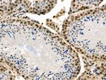 Phospho-MUC1 (Ser1227) Antibody in Immunohistochemistry (Paraffin) (IHC (P))