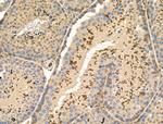 Phospho-NACA (Ser43) Antibody in Immunohistochemistry (Paraffin) (IHC (P))