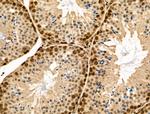 Phospho-NACA (Thr159) Antibody in Immunohistochemistry (Paraffin) (IHC (P))