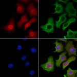 Phospho-PDX1 (Ser61) Antibody in Immunocytochemistry (ICC/IF)