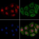 Phospho-PDX1 (Ser66) Antibody in Immunocytochemistry (ICC/IF)