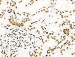 Phospho-PDX1 (Ser66) Antibody in Immunohistochemistry (Paraffin) (IHC (P))