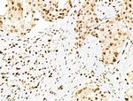 Phospho-PDX1 (Ser66) Antibody in Immunohistochemistry (Paraffin) (IHC (P))