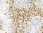 Phospho-PDX1 (Ser66) Antibody in Immunohistochemistry (Paraffin) (IHC (P))