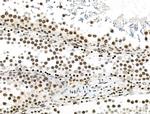 Phospho-PDX1 (Ser66) Antibody in Immunohistochemistry (Paraffin) (IHC (P))