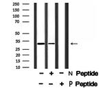 Phospho-PDX1 (Ser66) Antibody in Western Blot (WB)