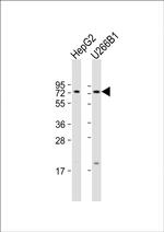 CD73 Antibody in Western Blot (WB)