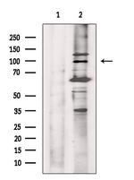 Phospho-Progesterone Receptor (Ser345) Antibody in Western Blot (WB)