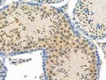 Phospho-RAD23A (Ser357) Antibody in Immunohistochemistry (Paraffin) (IHC (P))