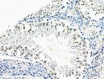 Phospho-RAD23A (Ser357) Antibody in Immunohistochemistry (Paraffin) (IHC (P))