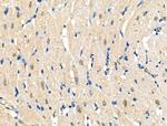 Phospho-RAD50 (Ser635) Antibody in Immunohistochemistry (Paraffin) (IHC (P))