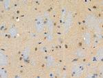 Phospho-RAD50 (Ser635) Antibody in Immunohistochemistry (Paraffin) (IHC (P))