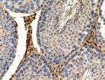 Phospho-TSC2 (Ser981) Antibody in Immunohistochemistry (Paraffin) (IHC (P))