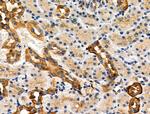 Phospho-TSC2 (Ser981) Antibody in Immunohistochemistry (Paraffin) (IHC (P))