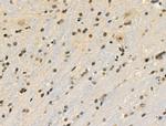 Phospho-Cyclin E (Ser399) Antibody in Immunohistochemistry (Paraffin) (IHC (P))