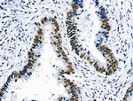 Phospho-Cyclin E (Ser399) Antibody in Immunohistochemistry (Paraffin) (IHC (P))