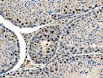 Phospho-Cyclin E (Ser399) Antibody in Immunohistochemistry (Paraffin) (IHC (P))