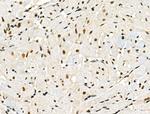 Phospho-Cyclin E (Ser399) Antibody in Immunohistochemistry (Paraffin) (IHC (P))