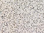 Phospho-Cyclin E (Ser399) Antibody in Immunohistochemistry (Paraffin) (IHC (P))