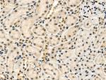 Phospho-Cyclin E (Ser399) Antibody in Immunohistochemistry (Paraffin) (IHC (P))