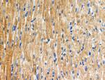 Phospho-PRK1/PRK2 (Thr774, Thr816) Antibody in Immunohistochemistry (Paraffin) (IHC (P))