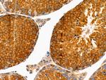 Phospho-Caspase 3 (Ser26) Antibody in Immunohistochemistry (Paraffin) (IHC (P))