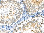 Phospho-Caspase 3 (Ser26) Antibody in Immunohistochemistry (Paraffin) (IHC (P))