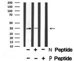 Phospho-Caspase 3 (Ser26) Antibody in Western Blot (WB)