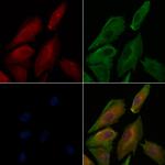 Phospho-E-cadherin (Ser844) Antibody in Immunocytochemistry (ICC/IF)