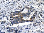 Phospho-E-cadherin (Ser844) Antibody in Immunohistochemistry (Paraffin) (IHC (P))