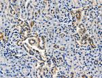 Phospho-E-cadherin (Ser844) Antibody in Immunohistochemistry (Paraffin) (IHC (P))