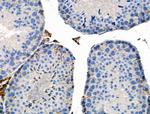 Phospho-E-cadherin (Ser844) Antibody in Immunohistochemistry (Paraffin) (IHC (P))