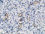 Phospho-E-cadherin (Ser844) Antibody in Immunohistochemistry (Paraffin) (IHC (P))