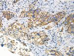 Phospho-GRK1/GRK2 (Tyr13) Antibody in Immunohistochemistry (Paraffin) (IHC (P))