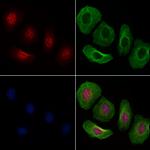 Phospho-CHK2 (Ser379) Antibody in Immunocytochemistry (ICC/IF)