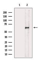 Phospho-CHK2 (Ser379) Antibody in Western Blot (WB)