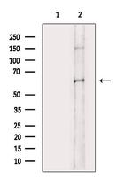 Phospho-CHK2 (Ser379) Antibody in Western Blot (WB)